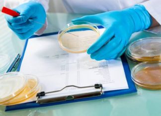 Հայտնաբերվել է «Ոսկեգույն ստաֆիլակոկ». հայտնի են Արմավիրի մարզի թունավորման լաբորատոր քննության արդյունքները